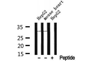 Western blot analysis of extracts from HepG2 and mouse heart, using CYB5R2 Antibody. (CYB5R2 antibody  (Internal Region))