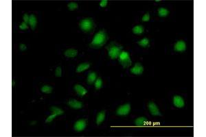 Immunofluorescence of purified MaxPab antibody to RBMS1 on HeLa cell. (RBMS1 antibody  (AA 1-406))