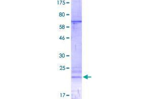 TACI Protein (AA 2-165) (His-DYKDDDDK-Strep II Tag)