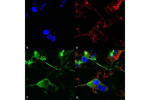 Immunocytochemistry/Immunofluorescence analysis using Mouse Anti-GABA-A Receptor Alpha 2 Monoclonal Antibody, Clone S399-19 (ABIN2485729). (GABRA1 antibody  (AA 350-385) (FITC))