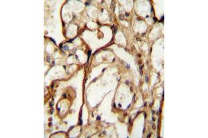 Immunohistochemistry (IHC) image for anti-Solute Carrier Family 3 (Activators of Dibasic and Neutral Amino Acid Transport), Member 2 (SLC3A2) antibody (ABIN2995541) (SLC3A2 antibody)