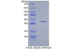 SDS-PAGE (SDS) image for Tumor Necrosis Factor (Ligand) Superfamily, Member 8 (TNFSF8) (AA 60-227) protein (His tag) (ABIN1170076) (TNFSF8 Protein (AA 60-227) (His tag))