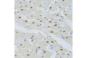Immunohistochemistry of paraffin-embedded mouse heart using DDB1 Antibody. (DDB1 antibody)