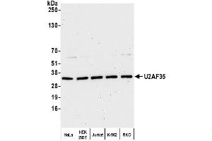 Western Blotting (WB) image for anti-U2 Small Nuclear RNA Auxiliary Factor 1 (U2AF1) (AA 140-190) antibody (ABIN7453889) (U2AF1 antibody  (AA 140-190))