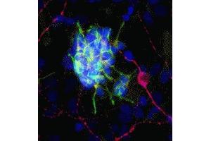 Immunofluorescence of cultured rat neurons showing strong cytoplasmic staining of doublecortin (green) in developing neurons and GFAP ( ABIN361379) in red. (Doublecortin antibody)
