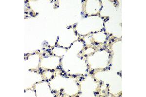 Immunohistochemistry of paraffin-embedded rat lung using PNKP antibody at dilution of 1:100 (x40 lens). (PNKP antibody)