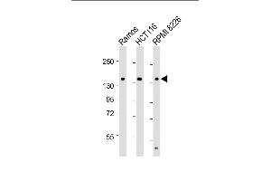All lanes : Anti-TI Antibody (C-term) at 1:2000 dilution Lane 1: Ramos whole cell lysate Lane 2: HC whole cell lysate Lane 3: RI 8226 whole cell lysate Lysates/proteins at 20 μg per lane. (TIAM1 antibody  (C-Term))