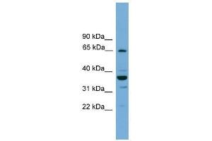 Western Blot showing TH1L antibody used at a concentration of 1-2 ug/ml to detect its target protein.