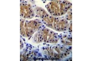 ANKRD5 Antibody (C-term) immunohistochemistry analysis in formalin fixed and paraffin embedded human stomach tissue followed by peroxidase conjugation of the secondary antibody and DAB staining. (ANKRD5 antibody  (C-Term))