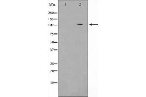 Western blot analysis on 293 cell lysate using E-cadherin Antibody,The lane on the left is treated with the antigen-specific peptide.