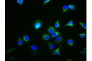 Immunofluorescence staining of A549 cells with ABIN7154549 at 1:44, counter-stained with DAPI. (GDF5 antibody  (AA 202-501))