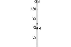 Western blot analysis of ALOX15B Antibody (C-term) in CEM cell line lysates (35µg/lane). (ALOX15B antibody  (C-Term))