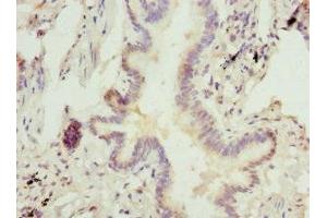 Immunohistochemistry of paraffin-embedded human lung tissue using ABIN7143016 at dilution of 1:100 (CHIA antibody  (AA 1-368))
