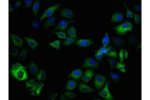 Immunofluorescence staining of Hela cells(treated with 50 mM Calyculin A for 30 min) with  at 1:100,counter-stained with DAPI. (Recombinant GSK3 beta antibody  (pSer9))