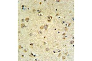 Immunohistochemistry analysis in formalin fixed and paraffin embedded brain tissue reacted with MAP4K3 Antibody , which was peroxidase conjugated to the secondary antibody and followed by DAB staining.