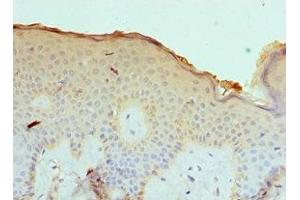 Immunohistochemistry of paraffin-embedded human skin tissue using ABIN7146937 at dilution of 1:100 (CASP14 antibody  (AA 1-242))