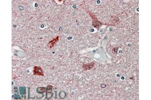 ABIN570984 (3. (CaMKII alpha/beta (Internal Region) antibody)