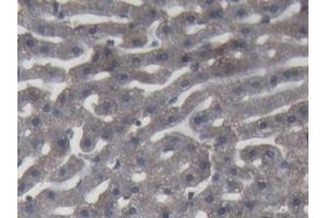 Detection of C9 in Rabbit Liver Tissue using Polyclonal Antibody to Complement Component 9 (C9) (C9 antibody  (AA 139-519))