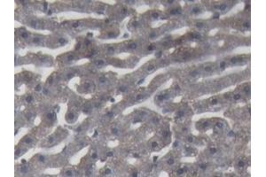 Detection of C9 in Rabbit Liver Tissue using Polyclonal Antibody to Complement Component 9 (C9) (C9 antibody  (AA 139-519))