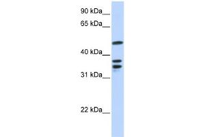WB Suggested Anti-ETV6 Antibody Titration:  0. (ETV6 antibody  (N-Term))