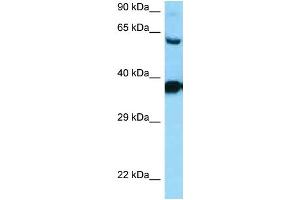 WB Suggested Anti-DRD3 Antibody Titration: 1.