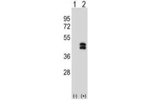 Western blot analysis of DUSP6 antibody and 293 cell lysate either nontransfected (Lane 1) or transiently transfected (2) with the DUSP6 gene.