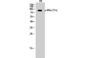 Western Blotting (WB) image for anti-conserved Helix-Loop-Helix Ubiquitous Kinase (CHUK) (pThr23) antibody (ABIN3172912) (IKK alpha antibody  (pThr23))