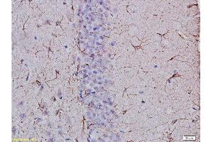 Formalin-fixed and paraffin embedded: rat brain tissue Anti-GFAP Polyclonal Antibody, Unconjugated  at 1:400, followed by conjugation to the secondary antibody and DAB staining (GFAP antibody  (AA 51-150))