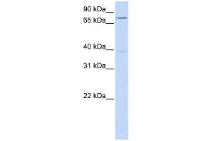 WB Suggested Anti-C17orf80 Antibody Titration:  0. (HLC8 antibody  (N-Term))