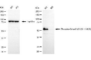 Western blotting analysis using phospho-Smad3 (S423 + S425) antibody (ABIN7800373).