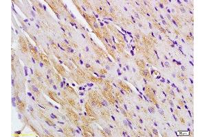 Formalin-fixed and paraffin embedded rat heart labeled with Anti-Titin/CMD1G Polyclonal Antibody, Unconjugated  at 1:200 followed by conjugation to the secondary antibody and DAB staining. (Titin antibody  (AA 2670-2703))