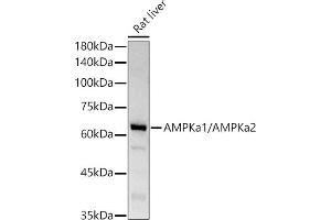 Western blot analysis of extracts of Rat liver, using AMPKa1/AMPKa2 antibody (ABIN6129902, ABIN6136848, ABIN6136849 and ABIN7101410) at 1:1000 dilution. (AMPK alpha antibody)