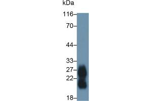 Detection of ZG16B in Human Saliva using Polyclonal Antibody to Zymogen Granule Protein 16 Homolog B (ZG16B) (ZG16B antibody  (AA 53-208))
