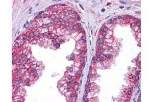 STAT6 antibody was used for immunohistochemistry at a concentration of 4-8 ug/ml. (STAT6 antibody  (C-Term))