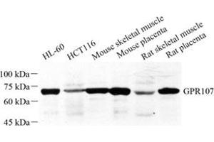 Western blot analysis of GPR107 (ABIN7073995) at dilution of 1: 500 (GPR107 antibody)