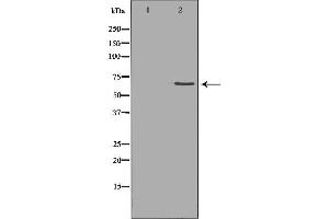 Western blot analysis of extracts of hela , using MMP14 antibody. (MMP14 antibody  (C-Term))