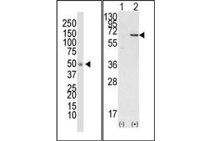 Image no. 1 for anti-Docking Protein 1, 62kDa (Downstream of tyrosine Kinase 1) (DOK1) (N-Term) antibody (ABIN359958) (DOK1 antibody  (N-Term))