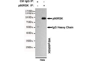 Immunoprecipitation analysis of Hela cell lysates using p90RSK mouse mAb. (RPS6KA3 antibody)