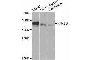 Western blot analysis of extracts of various cell lines, using NFKBIA antibody (ABIN5970533) at 1/1000 dilution. (NFKBIA antibody)