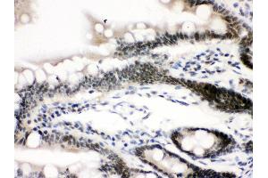 Anti-CTCF Picoband antibody, IHC(P) IHC(P): Rat Intestine Tissue (CTCF antibody  (AA 521-727))
