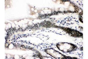 Anti-CTCF Picoband antibody, IHC(P) IHC(P): Rat Intestine Tissue (CTCF antibody  (AA 521-727))