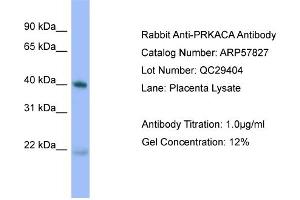 Western Blotting (WB) image for anti-Protein Kinase A, alpha (PRKACA) (N-Term) antibody (ABIN2787415)