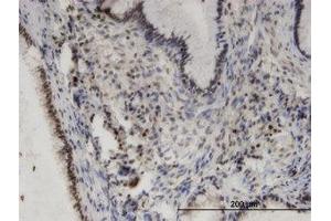 Image no. 1 for anti-Phosphorylase Kinase, alpha 2 (PHKA2) (AA 428-522) antibody (ABIN599415) (PHKA2 antibody  (AA 428-522))