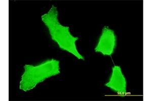 Immunofluorescence of monoclonal antibody to ERBB2 on HeLa cell. (ErbB2/Her2 antibody  (AA 22-121))