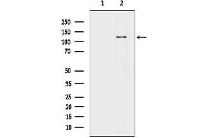 Western blot analysis of lysates from  cells(UV treatment), using AE2 Antibody.