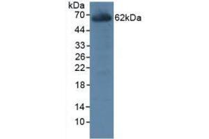 Detection of CES1 in Rat Liver Tissue using Polyclonal Antibody to Carboxylesterase 1 (CES1) (CES1 antibody  (AA 19-300))