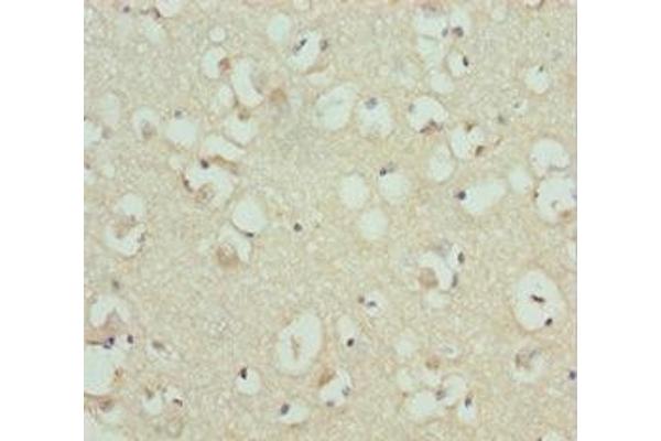 RDH12 antibody  (AA 182-316)