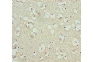 Immunohistochemistry of paraffin-embedded human brain tissue using ABIN7167840 at dilution of 1:100 (RDH12 antibody  (AA 182-316))