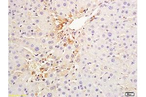 Formalin-fixed and paraffin embedded pig liver labeled with Anti-CK18 Polyclonal Antibody, Cy3 Conjugated (ABIN676973) at 1:200 for 60 minutes at 37C. (Cytokeratin 18 antibody  (AA 53-150))