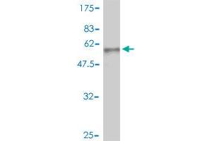 Western Blot detection against Immunogen (50. (HPRT1 antibody  (AA 1-218))